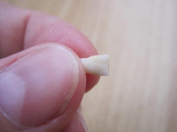 I medici avvertono: “Conservate i denti da latte dei vostri bambini, è importante”
