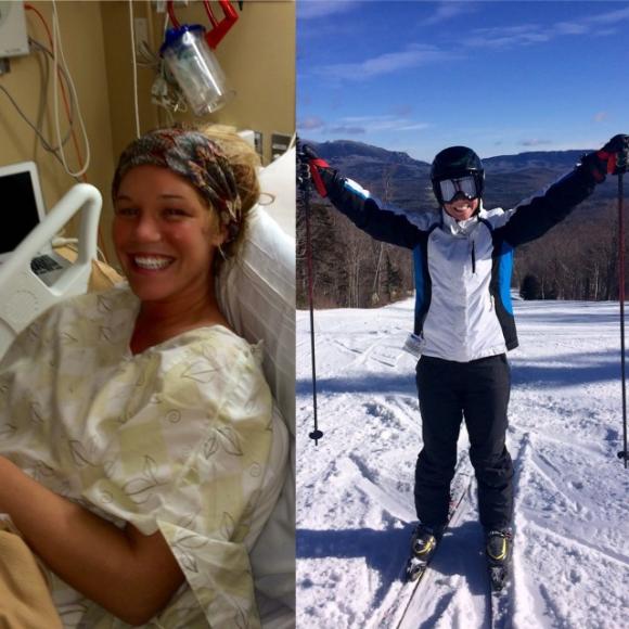 Sarah ebbe un ictus a 20 anni, il suo messaggio ha colpito tutti: “Non sottovalutate questi sintomi”