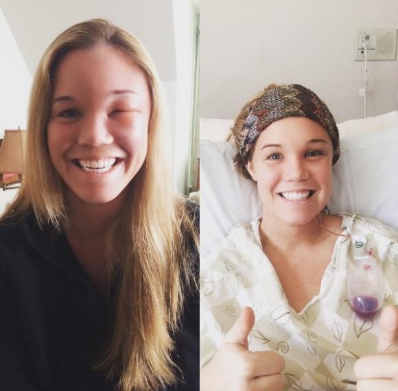 Sarah ebbe un ictus a 20 anni, il suo messaggio ha colpito tutti: “Non sottovalutate questi sintomi”