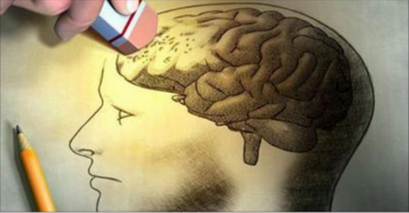Morbo di Alzheimer: scoperta la sostanza che lo causa. Ecco di cosa si tratta