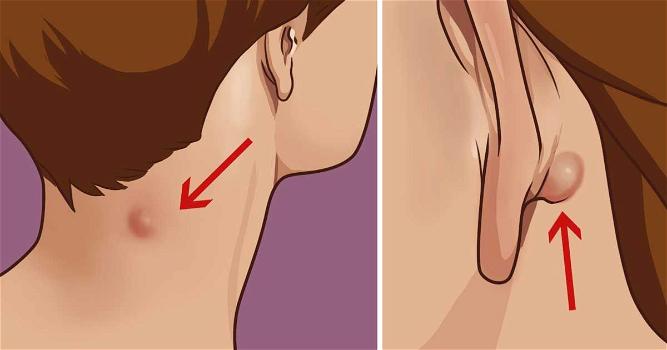 Hai una protuberanza sul collo o dietro l’orecchio? Ecco cosa dovresti assolutamente sapere