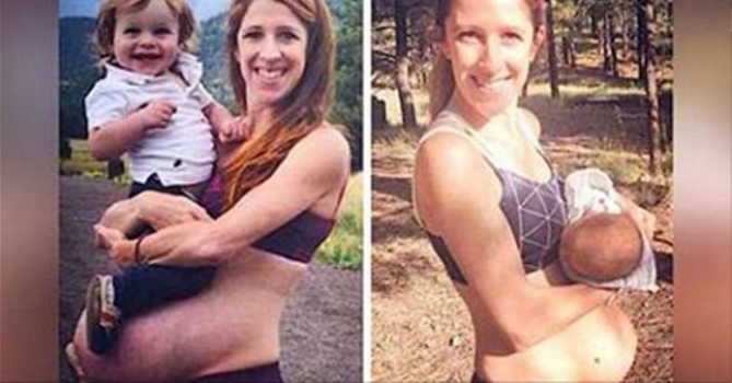 Ha due gravidanze a 15 mesi di distanza. Le sue foto mostrano un dettaglio che fa rabbrividire!