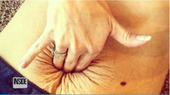 Ha due gravidanze a 15 mesi di distanza. Le sue foto mostrano un dettaglio che fa rabbrividire!