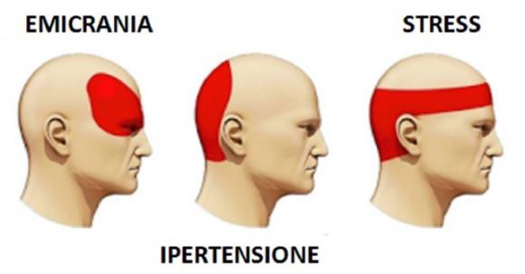 Come far passare il mal di testa senza medicine in modo rapido. Non potrai più fare a meno di questa tecnica!