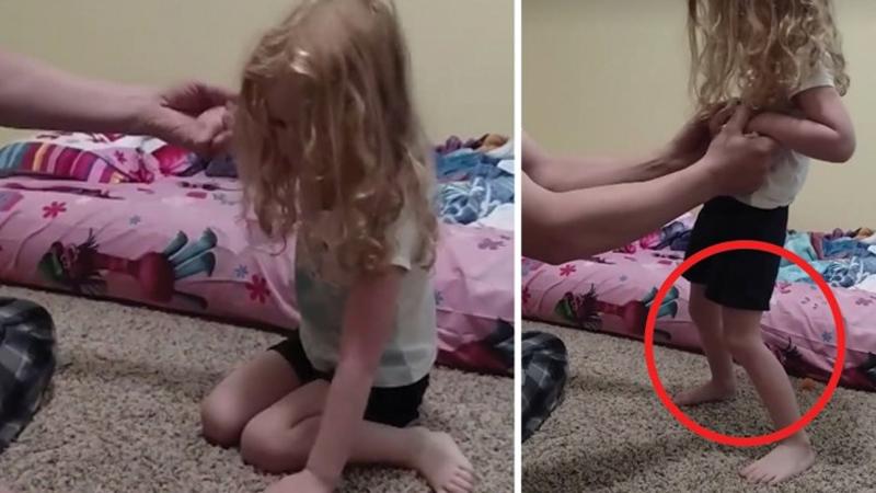 Ecco come si manifestano i sintomi del morso di una zecca. Può anche provocare la paralisi!