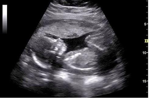 E’ stanca di sentirsi chiedere quando farà un figlio. La sua risposta è la migliore che si possa immaginare