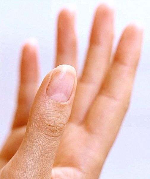 Avete anche voi questa mezzaluna sulle unghie? Ecco cosa significa