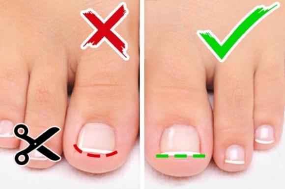 Ecco 6 semplici consigli per sfoggiare dei piedi bellissimi