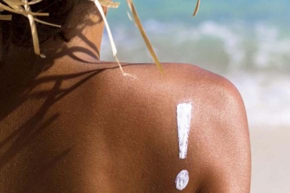 macchie bianche sulla pelle dopo il sole