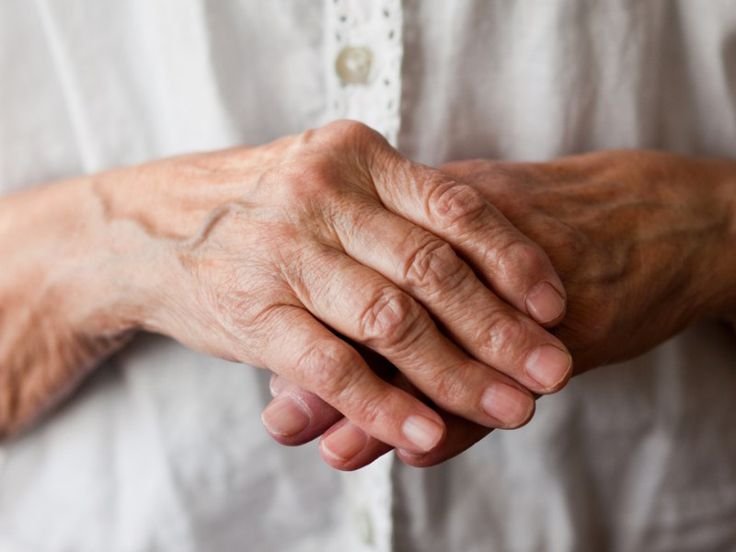 La causa scatenante dell’artrite reumatoide è praticamente sconosciuta. Si tratta, probabilmente, di una concomitanza di fattori ambientali e genetici