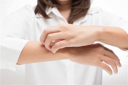 Dermatite atopica: cause, sintomi e rimedi naturali