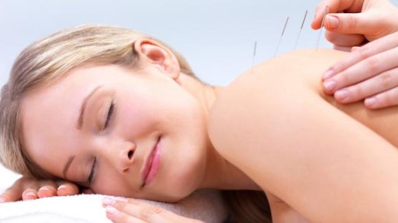Agopuntura: una terapia antica ma sempre valida