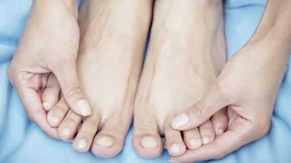 L'occhio di pernice si forma sul piede