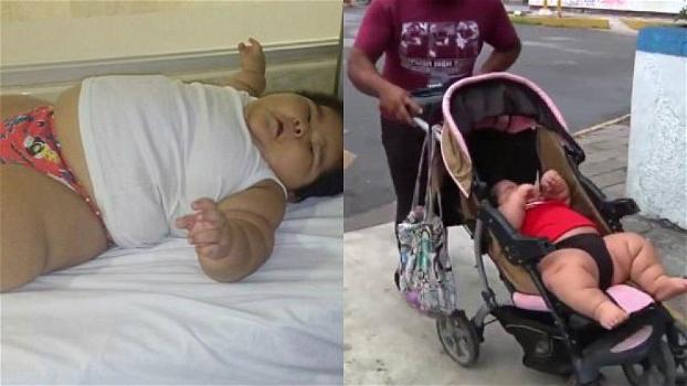 Messico: il piccolo Luis Manuel, affetto da disturbi ormonali, rischia la vita. La sua età vi lascerà basiti!
