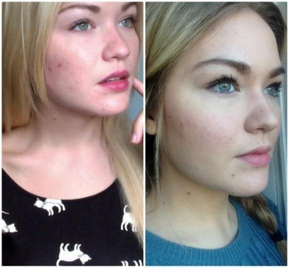Ecco come avere pelle e capelli sani e lucenti: vi servirà solo un po’ di miele