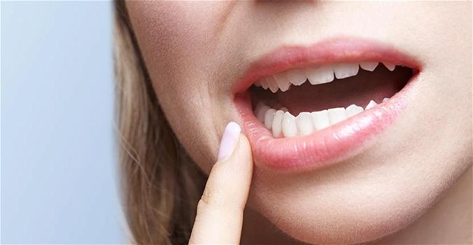 Bolle in bocca: come curarle con rimedi naturali