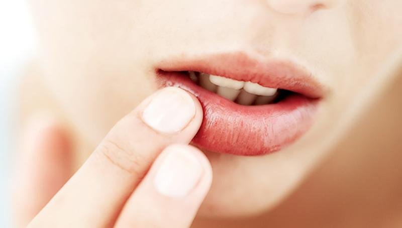 Le labbra gonfie possono essere causate da diversi fattori
