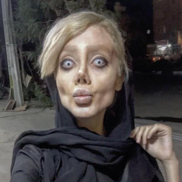 Oltre 50 operazioni di chirurgia per assomigliare ad Angelina Jolie: il risultato non è dei migliori…