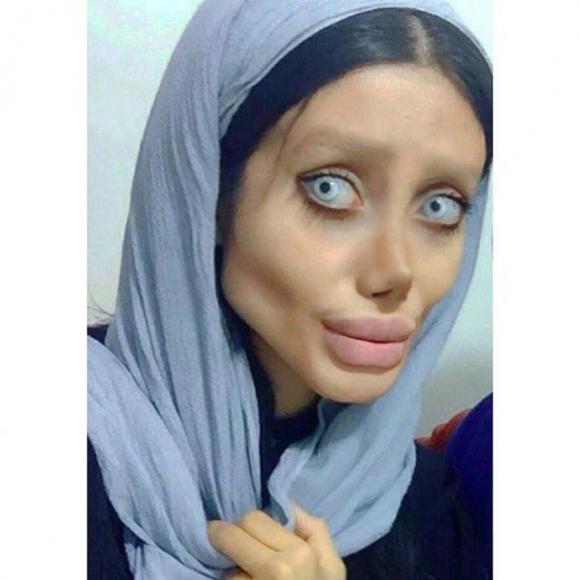 Oltre 50 operazioni di chirurgia per assomigliare ad Angelina Jolie: il risultato non è dei migliori…