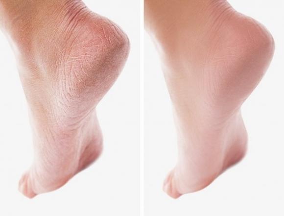 Ecco 12 segreti di bellezza dei quali pochi sono a conoscenza