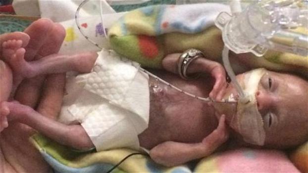 Nessuno immaginava che la bimba nata alla 21° settimana sopravvivesse: poi è avvenuto il miracolo!