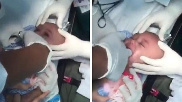 Il pediatra salva il neonato dal soffocamento. Quello che tira fuori dalla sua gola è assurdo!