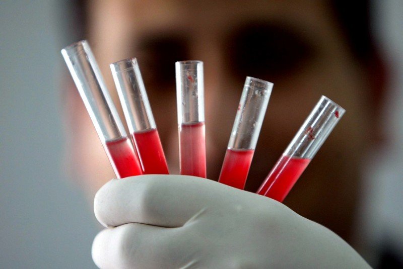 I soggetti talassemici dovranno sottoporti a trasfusioni e a prelievi di sangue continui, per tenere sotto controllo i livelli di emoglobina