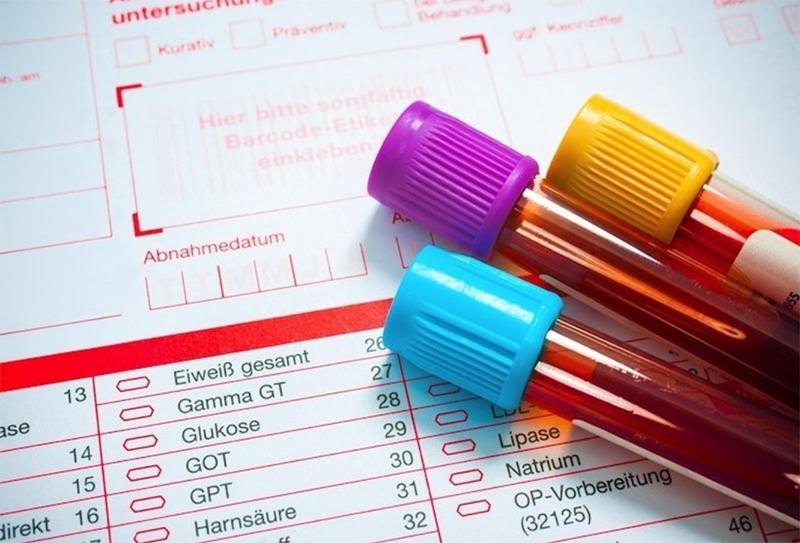 Creatinina bassa nel sangue o nelle urine: sintomi, cause e cosa fare