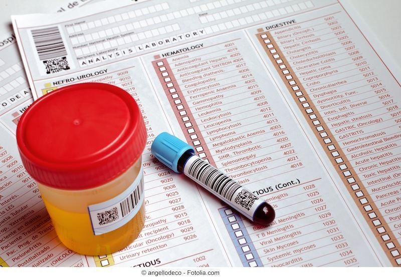 Eritrociti alti nelle urine cosa significa, le cause e valori normali