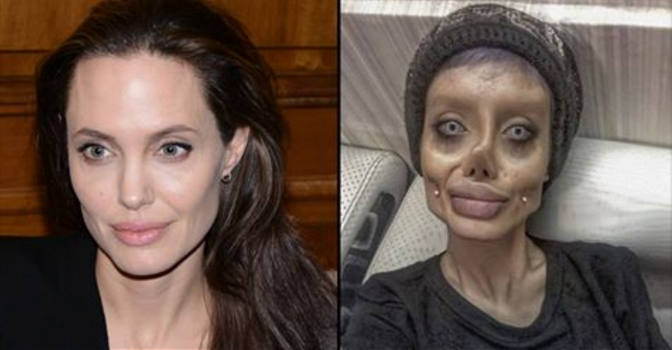 Oltre 50 operazioni di chirurgia per assomigliare ad Angelina Jolie: il risultato non è dei migliori…