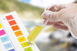 leucociti_nelle_urine_05