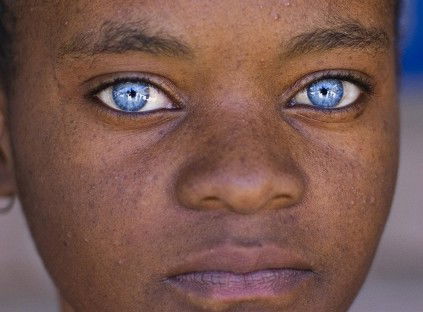 Le chiamano anomalie genetiche, ma possono portare la bellezza ad un livello superiore!