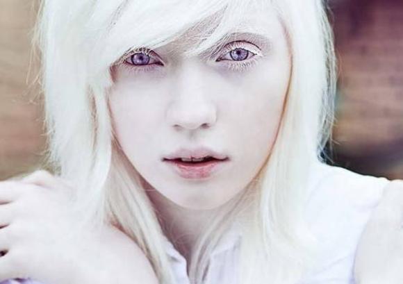 Le chiamano anomalie genetiche, ma possono portare la bellezza ad un livello superiore!