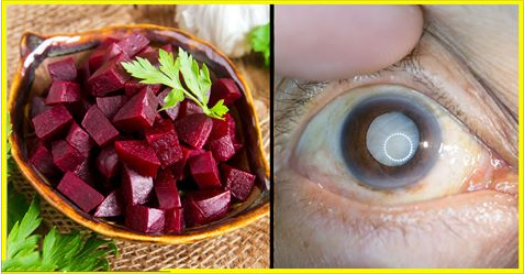 La combinazione di questi 3 alimenti è un toccasana per gli occhi, e aiuta anche a dimagrire!