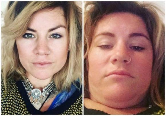 Queste ragazze mostrano il lato “oscuro” delle belle foto postate sui social network