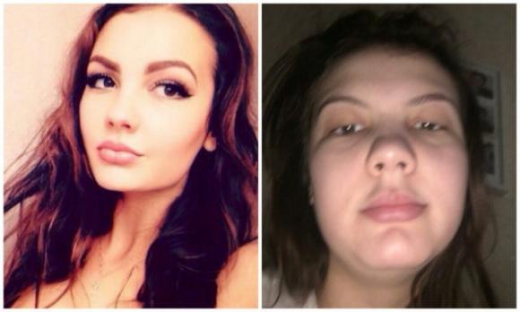 Queste ragazze mostrano il lato “oscuro” delle belle foto postate sui social network