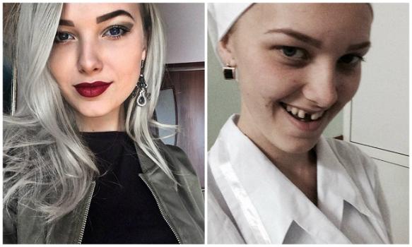 Queste ragazze mostrano il lato “oscuro” delle belle foto postate sui social network