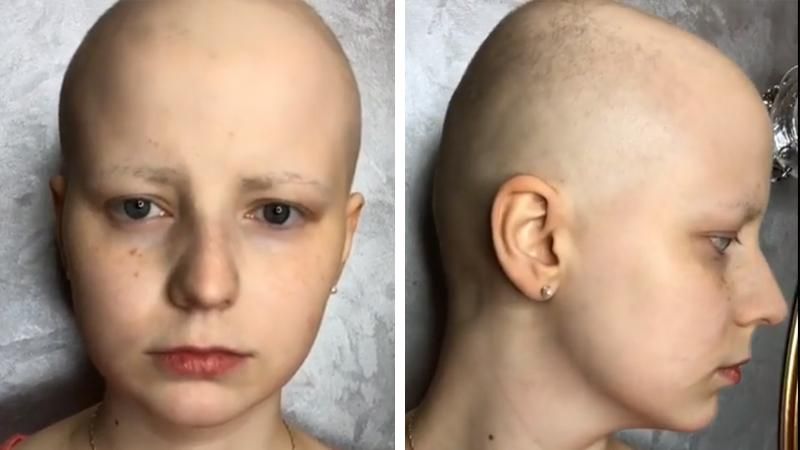 Essere bella nonostante il cancro: la sua trasformazione con il make up è commovente!