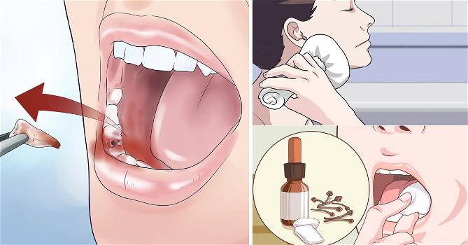 Ecco alcuni rimedi naturali per curare il mal di denti