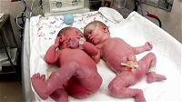 Questi gemelli sono nati con parto cesareo. Poi li mettono vicini e accade qualcosa di stupendo