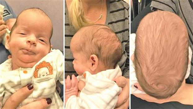 Un donna partorisce tre gemelli. Poco dopo i medici notano qualcosa di strano sulle loro teste