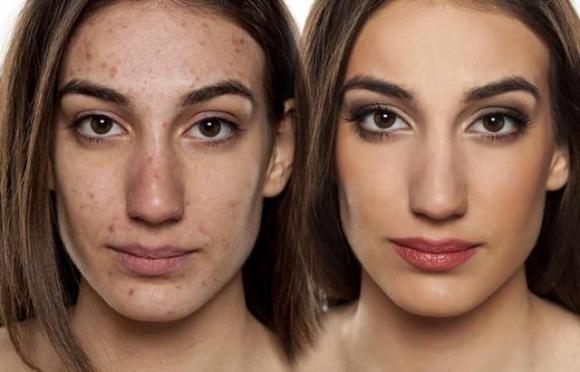 Versa il collutorio in un batuffolo di cotone e lo passa sotto le ascelle: il risultato è inaspettato!