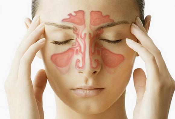 Come curare la sinusite in 20 secondi con un solo ingrediente naturale