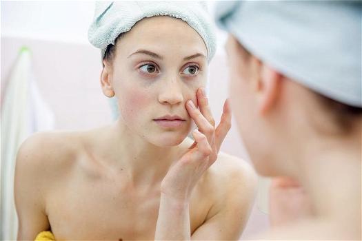 Pori dilatati sul viso: rimedi naturali e terapia medica indicata