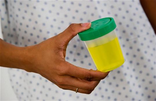Proteine nelle urine in gravidanza: cause, valori normali e cosa si deve fare