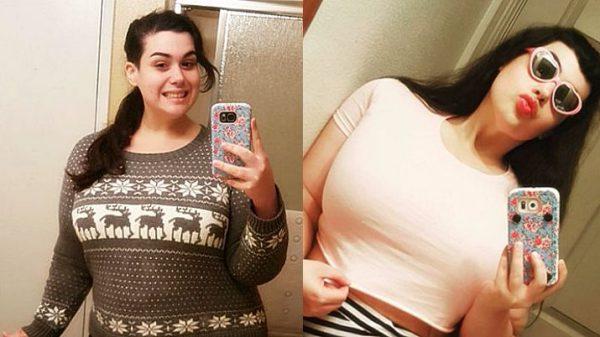 La battaglia di Amber contro l’obesità: ha perso 128 kg in un anno