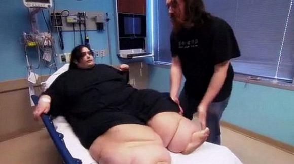 La battaglia di Amber contro l’obesità: ha perso 128 kg in un anno