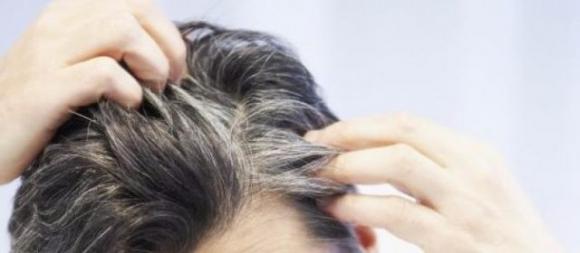 Ecco perché ti vengono i capelli bianchi prima dei 30 anni