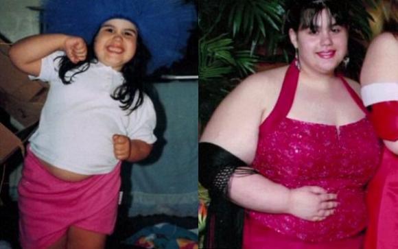La battaglia di Amber contro l’obesità: ha perso 128 kg in un anno