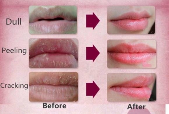 11 stupefacenti usi estetici della Vaselina che ti sorprenderanno